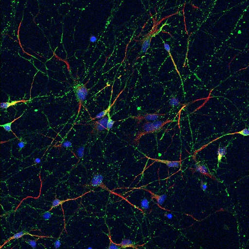 culture de Neurones dérivés d'iPSC marqués avec le marqueur somato-dendritique MAP2+ (rouge) et un marquage post-synaptique (PSD95, vert). © Emmanuel Nivet, INP Marseille INEM-Mocos neurone immunocyto