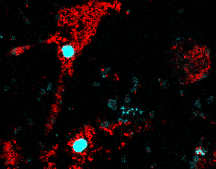 Cellule de l'immunité activée projet equipe allergie