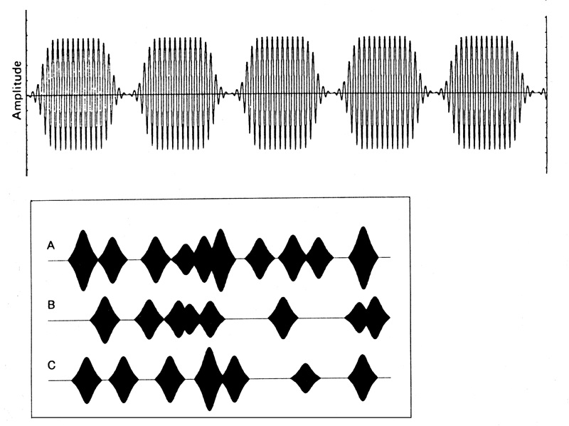 synthèse granulaire synthèse granulaire