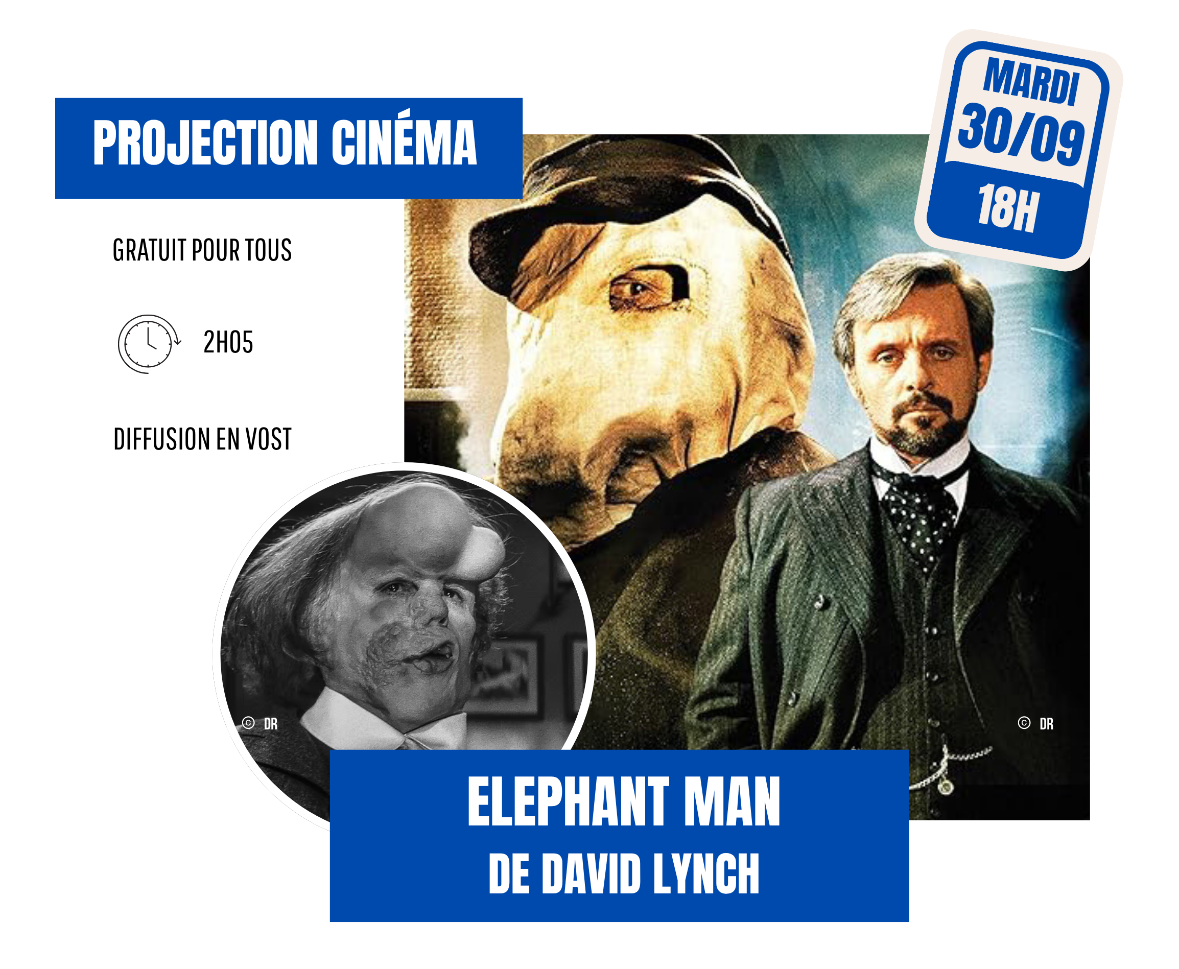 Elephant Man