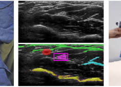 Robot image echographique