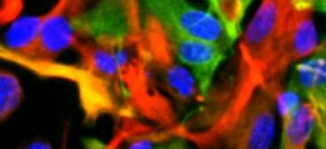 Neurotoxicité & développement