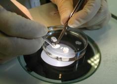 microdissection