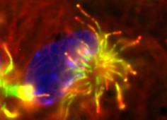 ependymocyte
